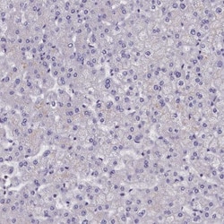 SUR1 Antibody, Novus Biologicals:Antibodies:Primary Antibodies